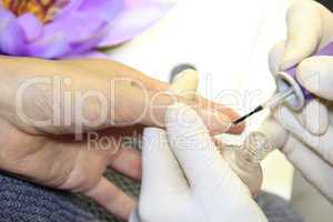 Female Hand - in manicure treatment - before
