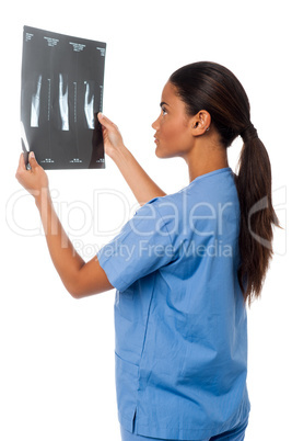Young doctor looking at scanned x-ray report
