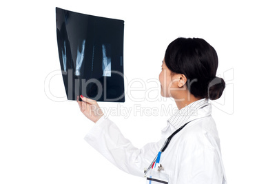 Female doctor looking at scanned x-ray report