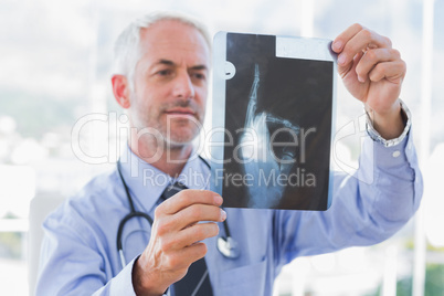 Doctor holding an x-ray