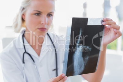 Serious nurse holding an x-ray