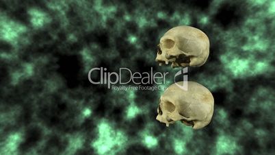 Hydrocephalic Human Skull Animation, side view on background