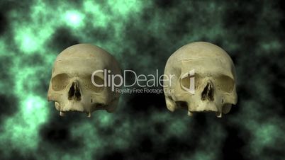 Hydrocephalic Human Skull Animation, top view on background