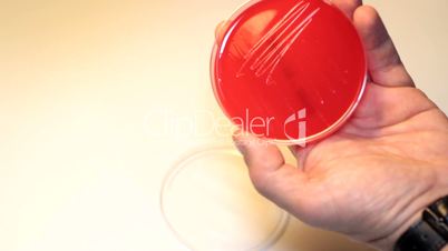 Medical Lab - petri dish - nutrient solution