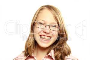 Fröhlicher Teenager mit Zahnspange