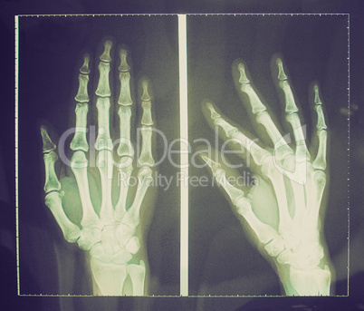 retro look xray