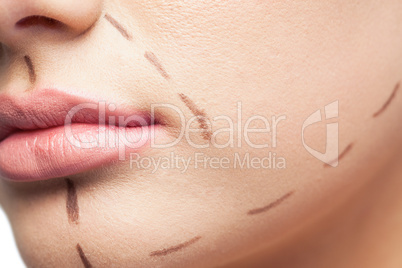 Extreme close up on gorgeous patient with dotted lines on the fa