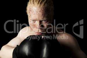albino boxer