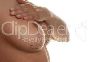 surgical guidelines on a naked female breast