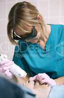 doctor doing a laser treatment on a womans foot