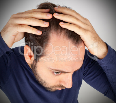 Man controls hair loss