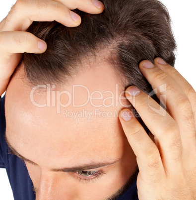 Man controls hair loss