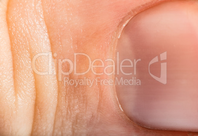 close up human skin and claw. macro epidermis