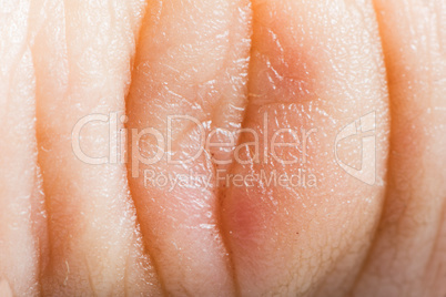 close up human skin. macro epidermis