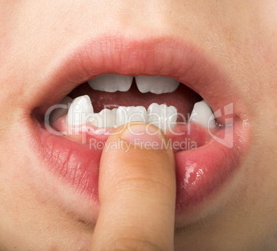 child shows tooth