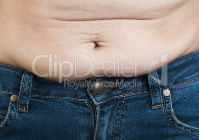 woman pinching fat from her abdomen
