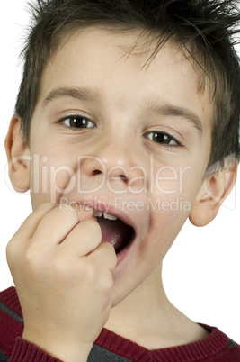 little boy shows a broken tooth