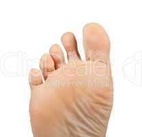 Athlete's foot,  Tinea pedis