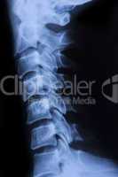 spine x ray