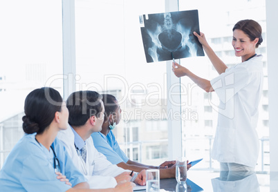 Doctor explaining x-ray to her team during a meeting