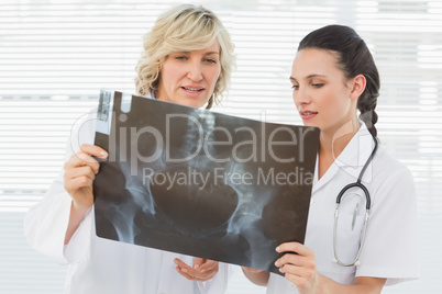 Two serious female doctors examining x-ray