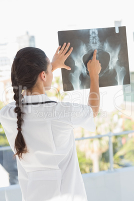 Rear view of a female doctor examining x-ray
