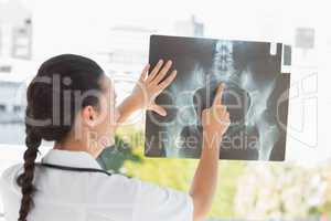 Rear view of a female doctor examining x-ray