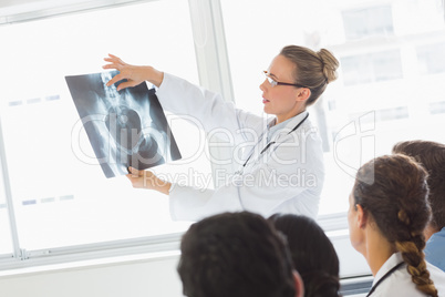 Doctor explaining Xray to colleagues