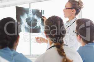 Doctor discussing Xray with colleagues