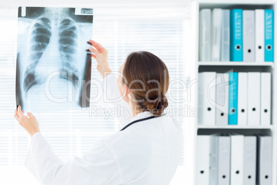 Female doctor studying Xray