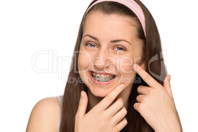 smiling girl with braces squeezing pimple isolated