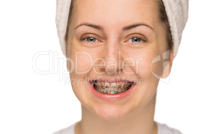 cheerful girl with braces isolated