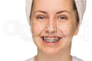 cheerful girl with braces isolated