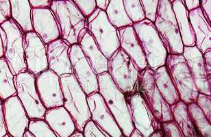 Onion epidermus micrograph
