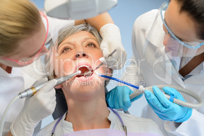 Senior woman patient dental check dentist team