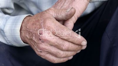 Scraped overworked hands of senior man