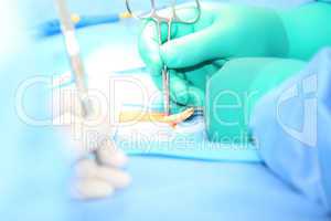 Open hernia surgery