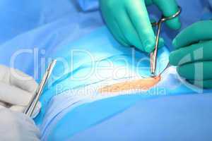 Macro shot of doctors making a suture in operation room.  Focus