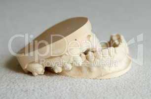 Dental gypsum model mould of teeth