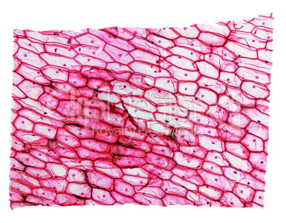 Onion epidermus micrograph