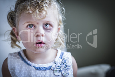 Sad, Bruised and Frightened Little Girl