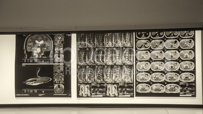 X-ray scans on a hospital wall