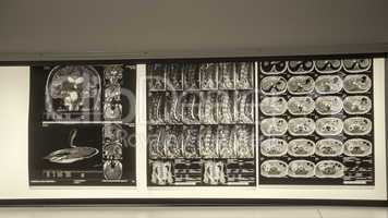 X-ray scans on a hospital wall