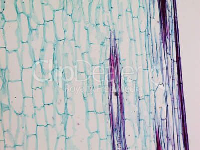 Corn stem micrograph