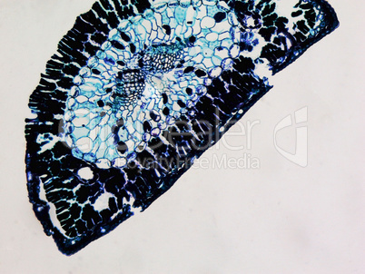 Pine leaf micrograph