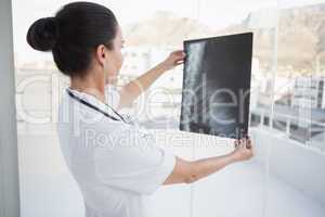 Doctor checking a patients x ray