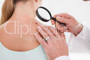 Doctor examining a brown spot