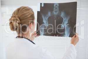 Focused doctor looking at xray