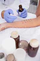 Doctor carrying out a skin prick test