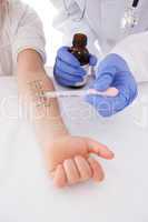 Doctor doing skin prick test at his patient